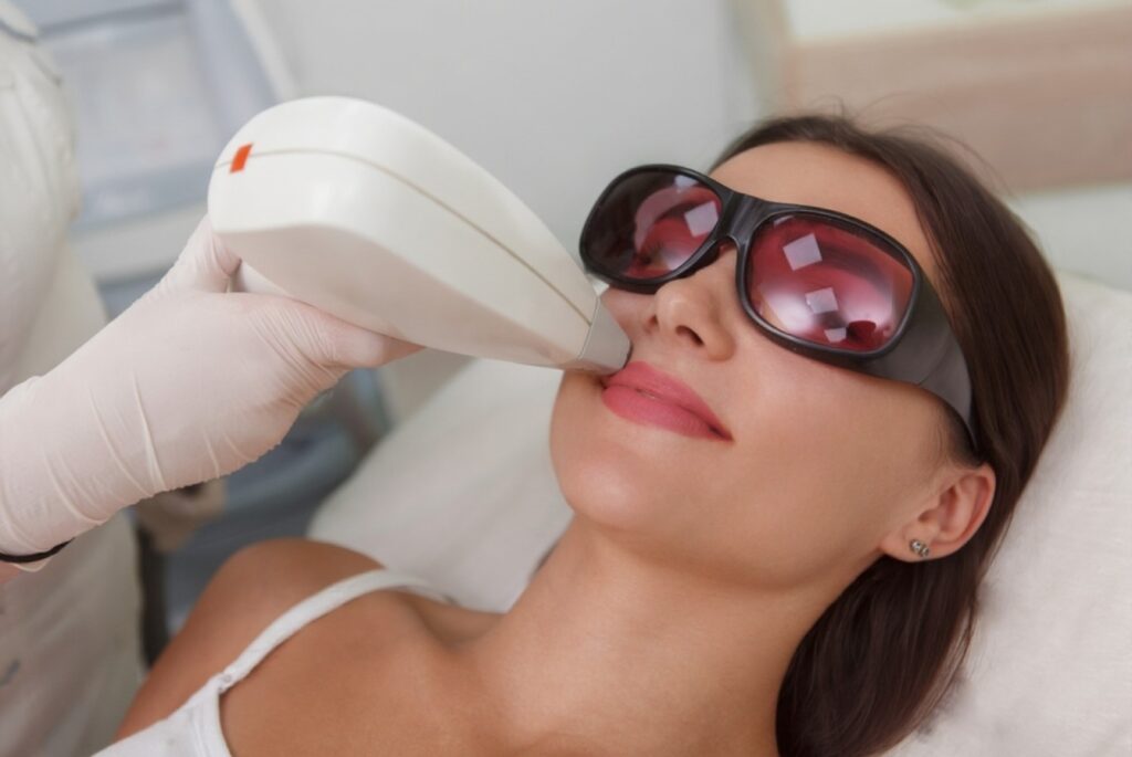 Upper Lip Hair Removal Treatment
