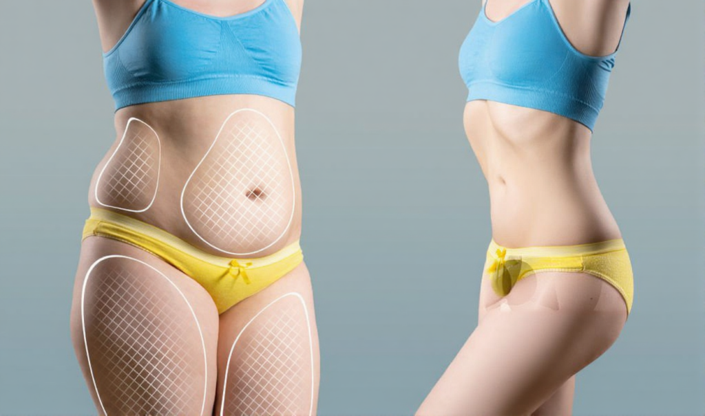 Spot Reduction Weight Loss Treatment