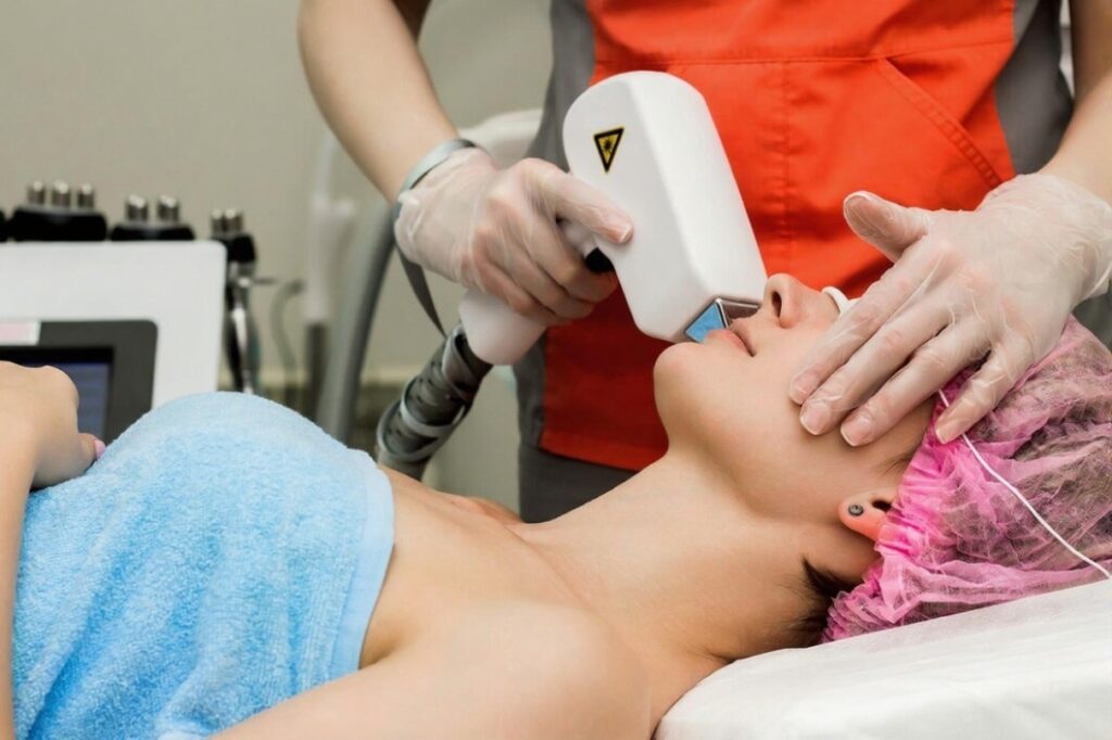 Facial Hair Laser Removal
