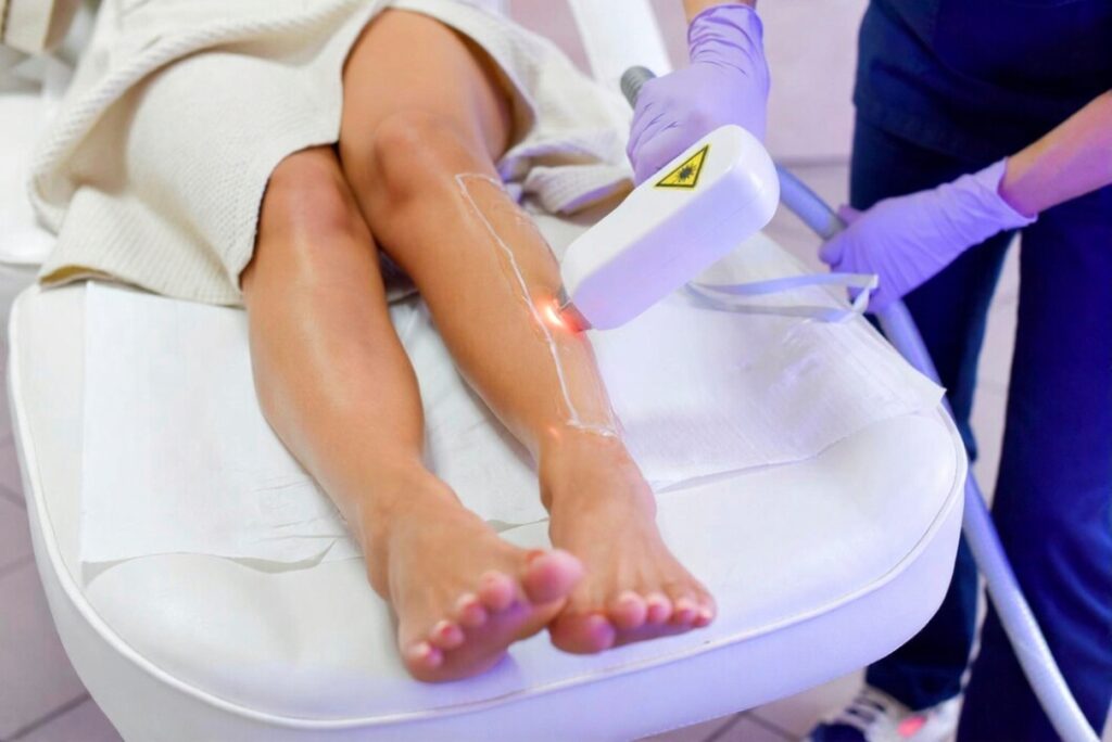 Legs Hair Removal Treatment