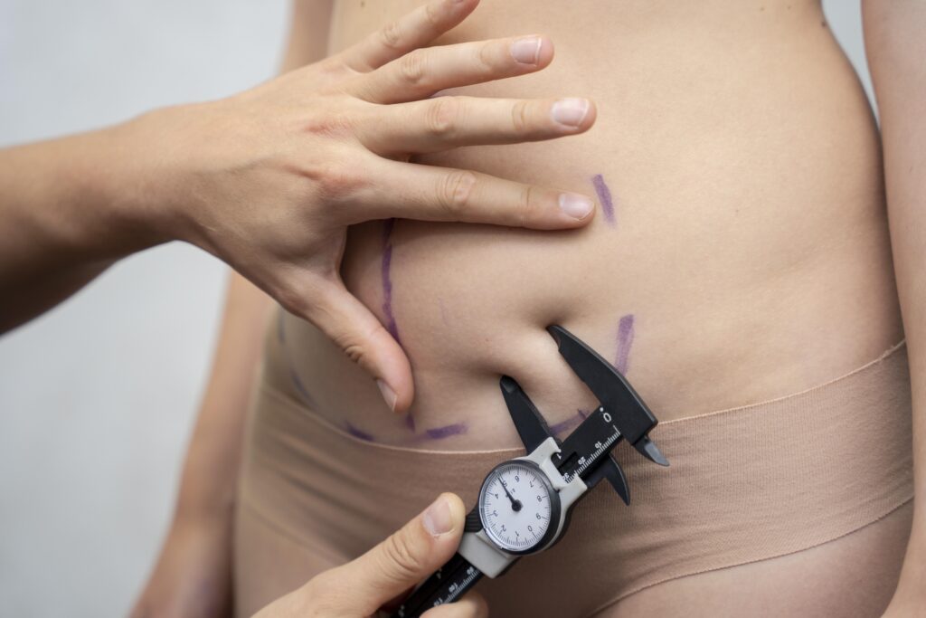 Spot Reduction Weight Loss Treatment