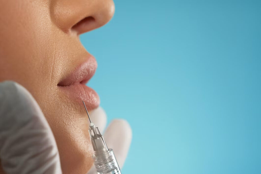 Dermal Filler Treatment