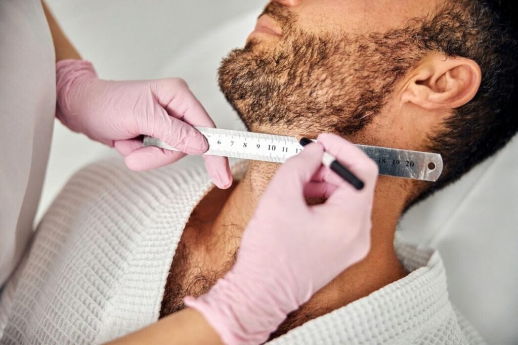 Beard Line Shaping Treatment