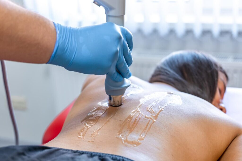 Back & Chest Hair Removal Treatment