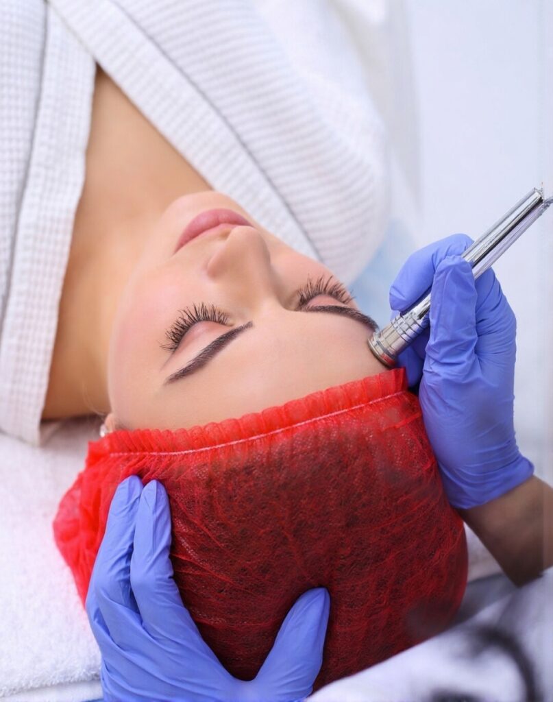 Microdermabrasion Treatment