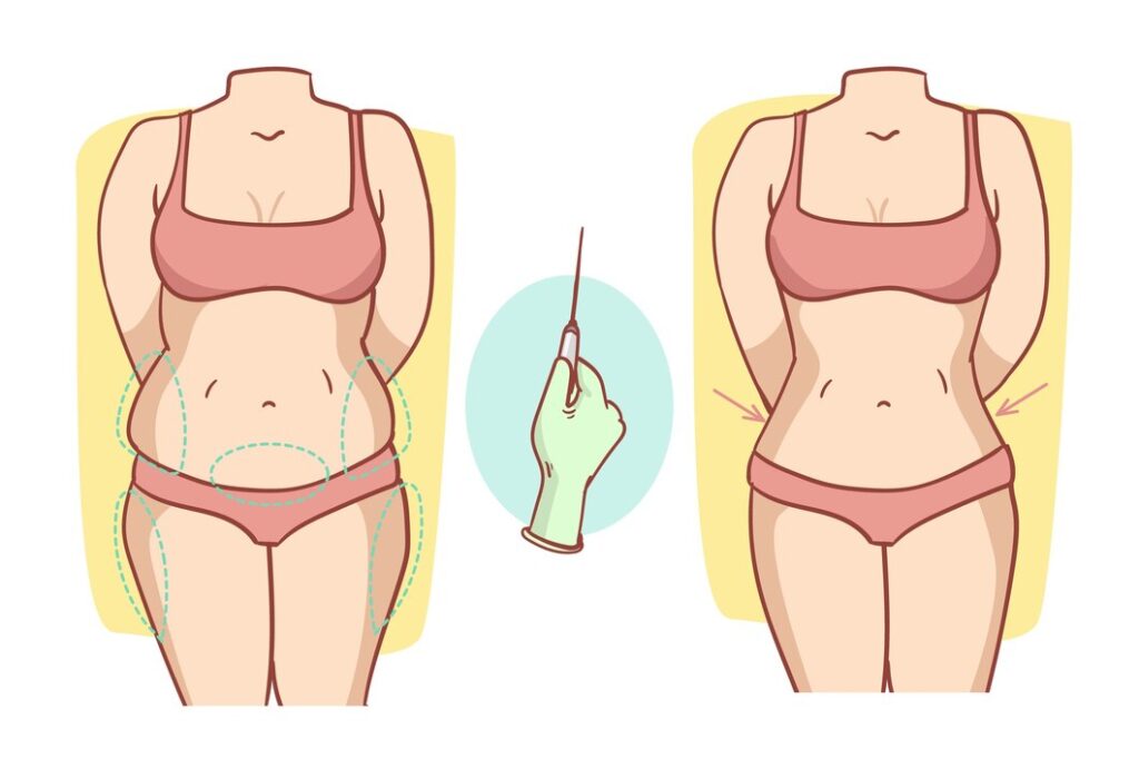 Tummy Shaping
