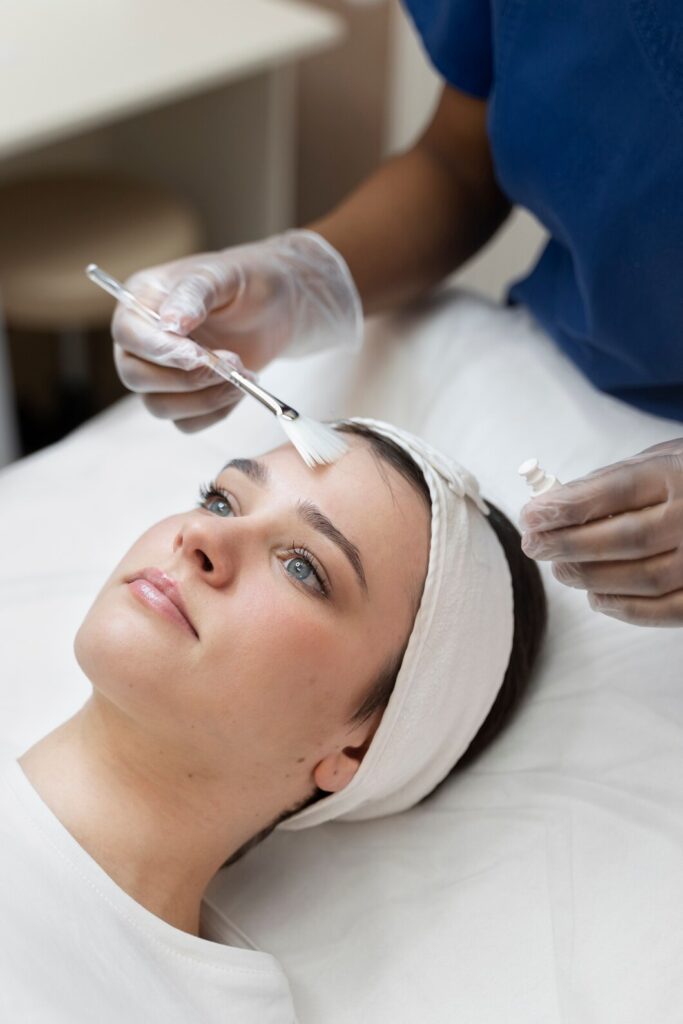 TCA Peel Treatment