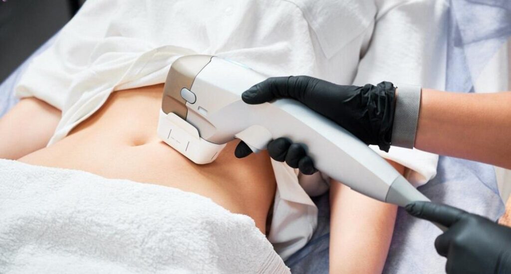 Ultrasonic Liposuction