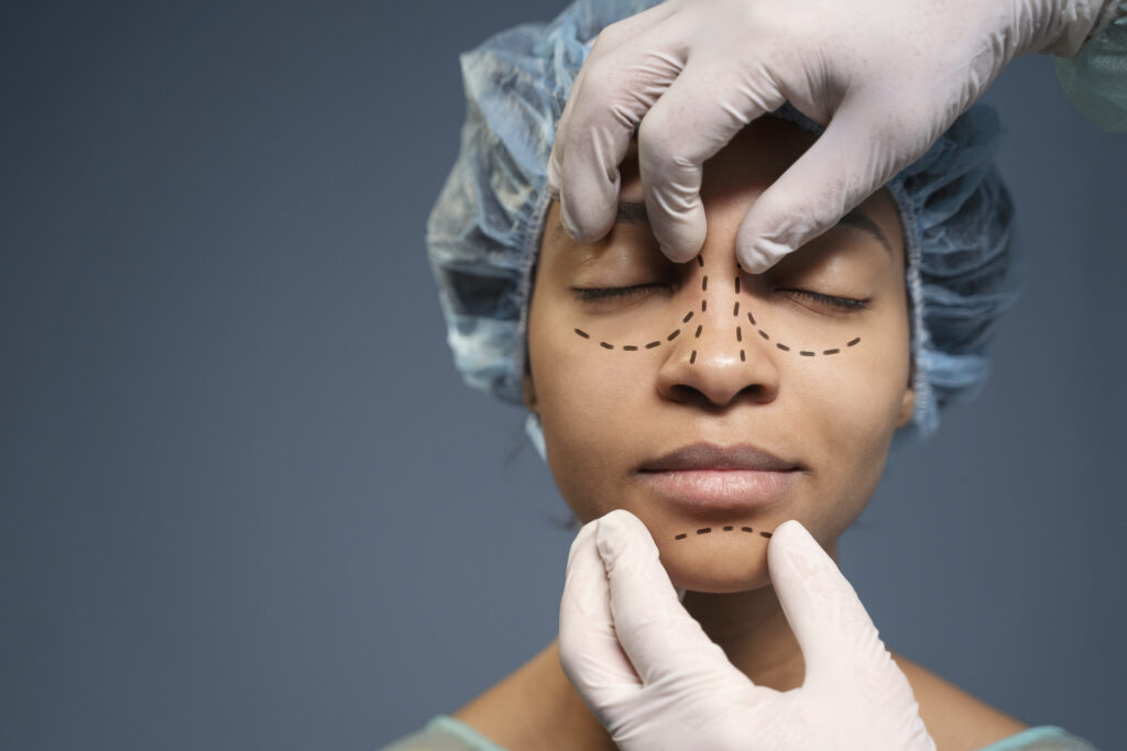 Thread Lift Treatment