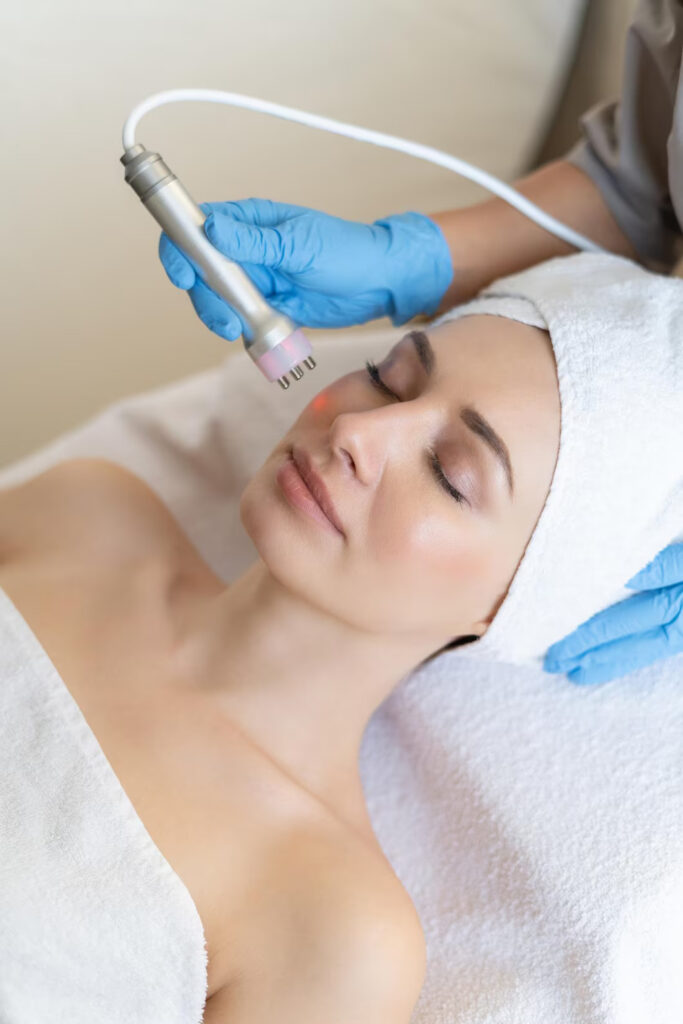Radio Frequency Face Treatment