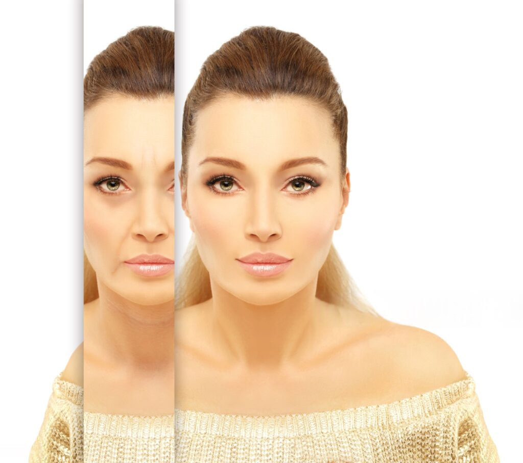 HIFU Face Treatment
