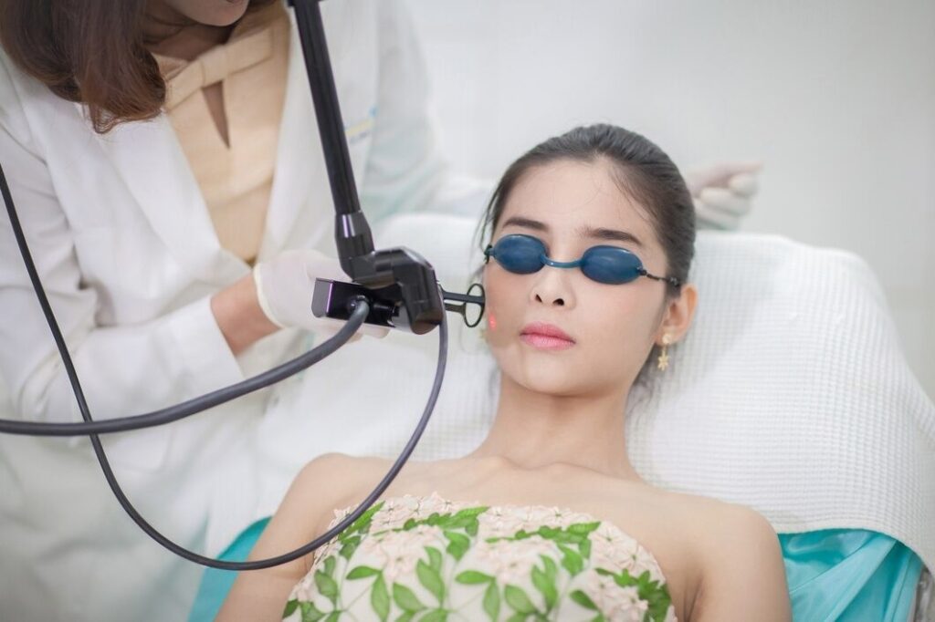 Q-Switch Laser Treatment