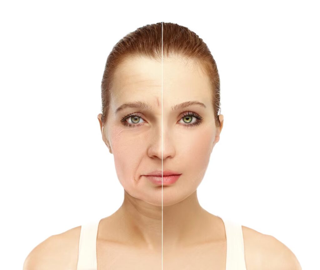 HIFU Face Treatment