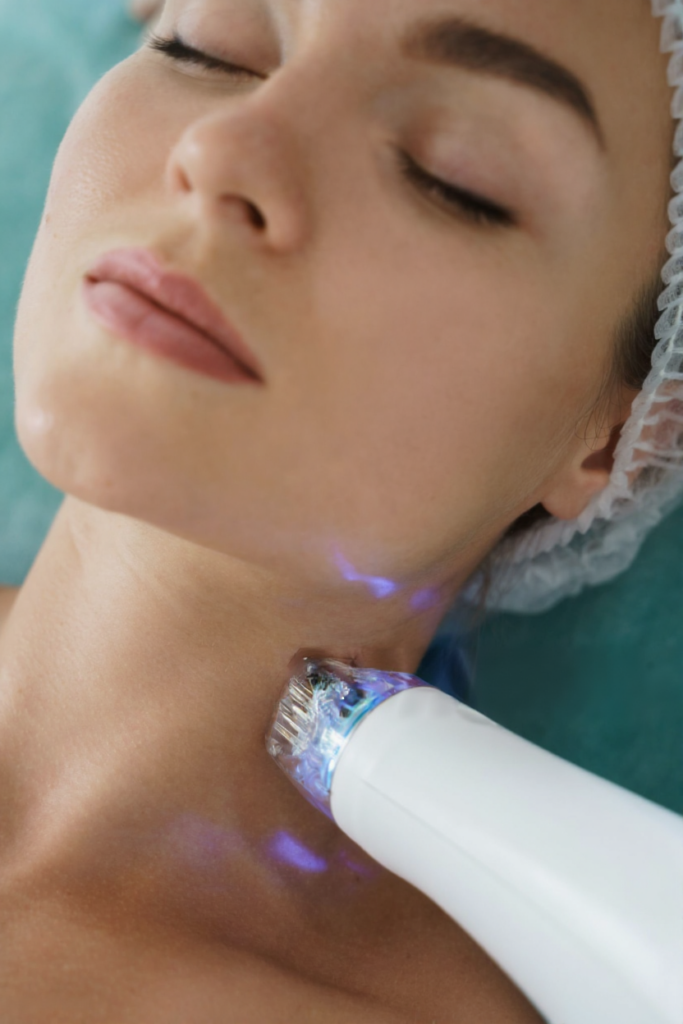 RF Microneedling Treatment