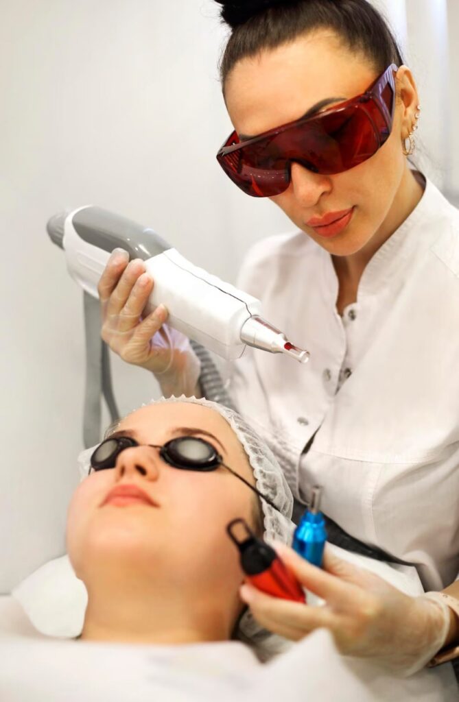 Pico Laser Treatment