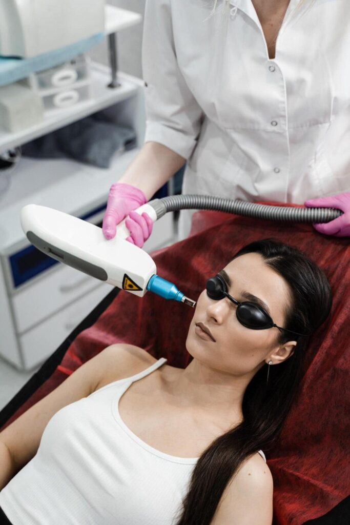 Q-Switch Laser Treatment